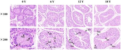 Transcriptome sequencing reveals the effects of circRNA on testicular development and spermatogenesis in Qianbei Ma goats